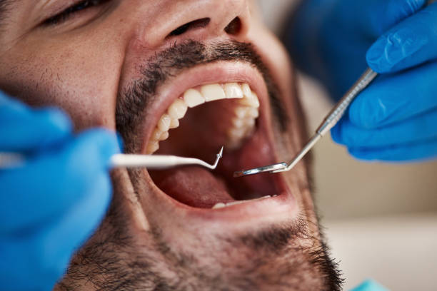 Best Pediatric Emergency Dentist in Bronxville, NY